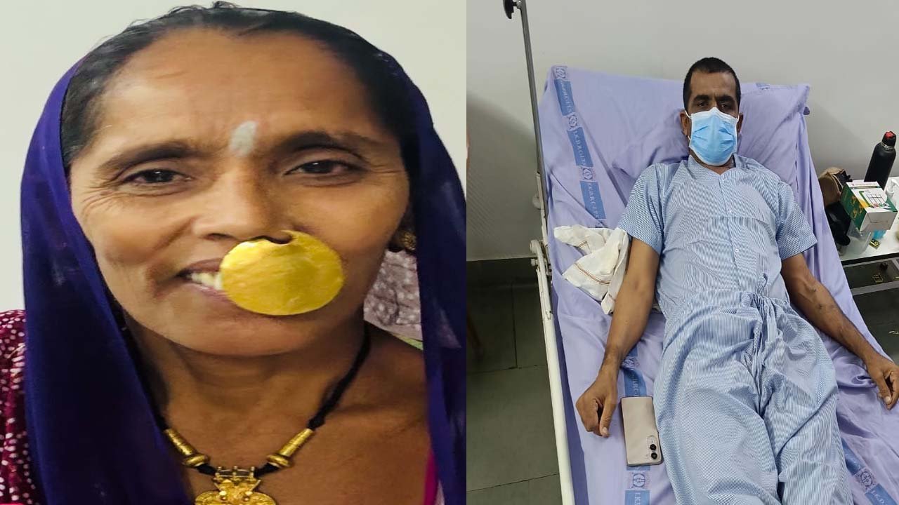 પાડણ ગામમાં ભાઈ–બહેનના બંધનની મિસાલ: બહેને કિડની આપી ભાઈને નવી જિંદગી ભેટ